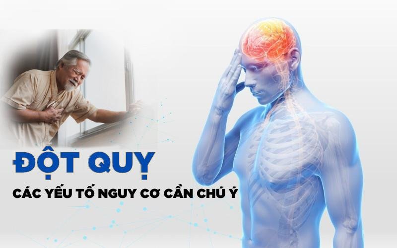 Đột quỵ tuổi 20: Khi Gen Z "gục ngã" trên bàn phím vì thói quen Tắm Đêm và Chạy Deadline